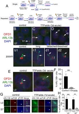 Tumor Treating Fields Suppression of Ciliogenesis Enhances Temozolomide Toxicity